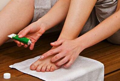 primjena masti za liječenje gljivica noktiju na nogama