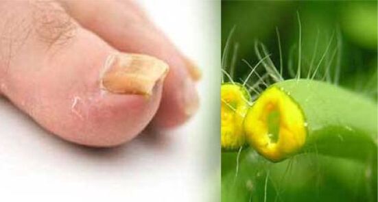 biljka celandina za gljivu na noktima noktiju